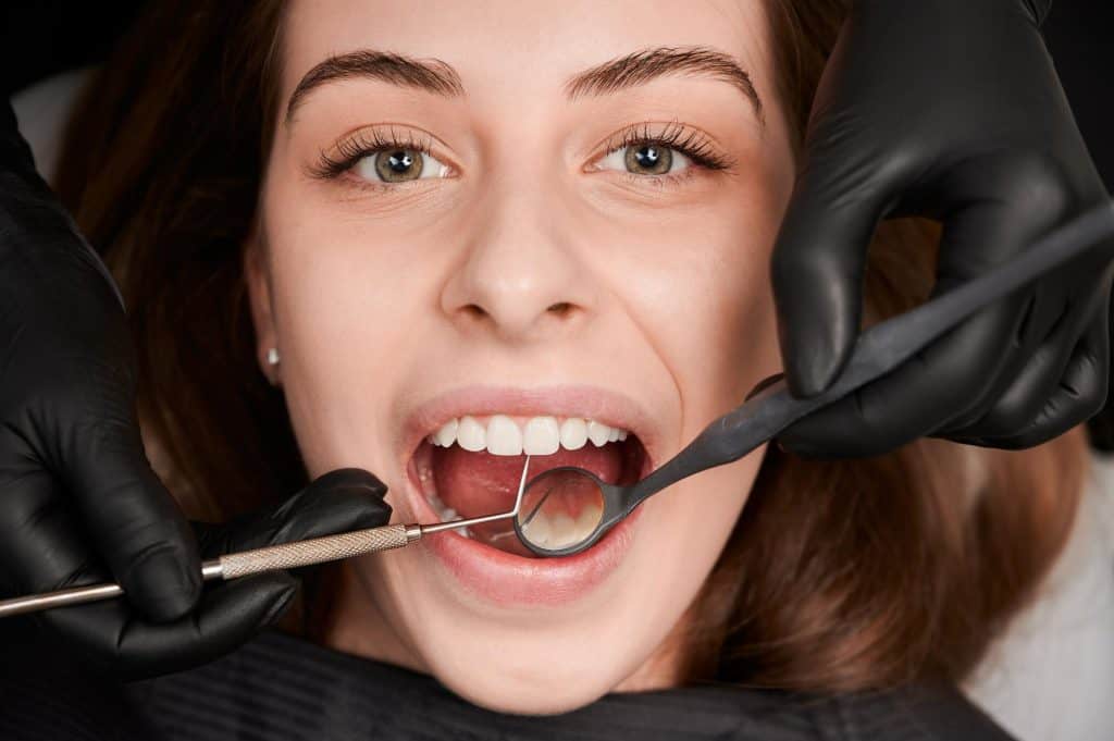 Dental Fillings Perth