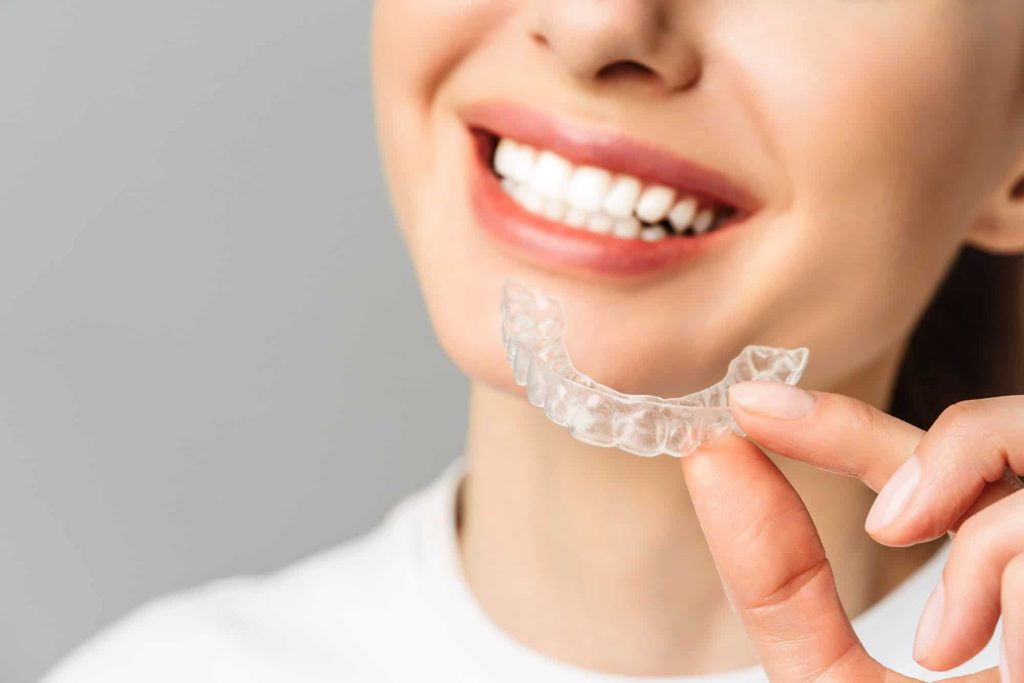 Invisalign Smile